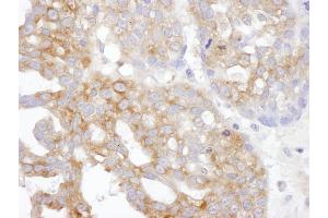 anti-Taxilin alpha (TXLNA) (AA 496-546) antibody