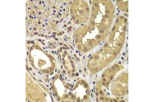 Immunohistochemistry of paraffin-embedded human kidney using SORT1 antibody. (Sortilin 1 antibody  (AA 520-760))