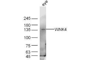 Mouse eye lysates probed with WNK4 Polyclonal Antibody, Unconjugated  at 1:300 dilution and 4˚C overnight incubation. (WNK4 antibody  (AA 351-450))