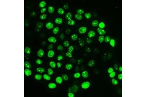 IF analysis of Ki67 using anti-Ki67 antibody (ABIN7601101).