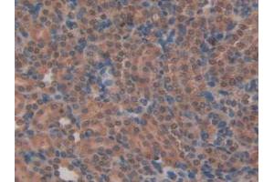 IHC-P analysis of Rat Kidney Tissue, with DAB staining. (MYH6 antibody  (AA 419-666))