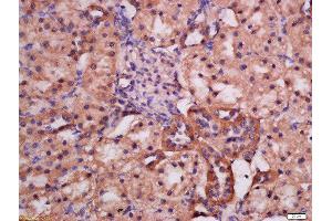 Formalin-fixed and paraffin embedded rat kidney labeled with Rabbit Anti-ATG9A(Ser735) Polyclonal Antibody, Unconjugated (ABIN756307) at 1:200 followed by conjugation to the secondary antibody and DAB staining