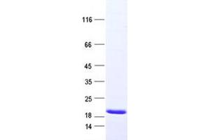 Validation with Western Blot (CPLX2 Protein (DYKDDDDK Tag))