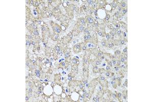 Immunohistochemistry of paraffin-embedded human liver injury using MUC16 antibody (ABIN6003713) at dilution of 1/100 (40x lens). (MUC16 antibody)