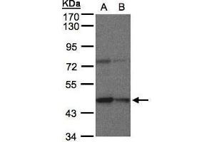 WB Image Sample(30 μg of whole cell lysate) A:HeLa S3, B:Hep G2, 7. (CPB1 antibody)