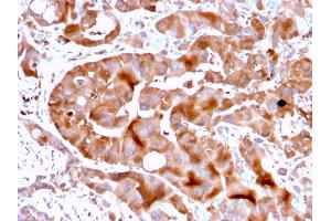 Formalin-fixed, paraffin-embedded human Liver tissue stained with FABP5 Mouse Monoclonal Antibody (FABP5/3750). (FABP5 antibody)