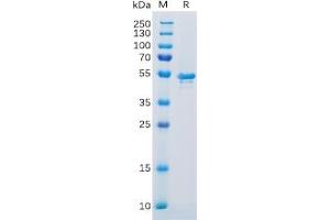 Human CA9 Protein, His Tag on SDS-PAGE under reducing condition. (CA9 Protein (His tag))