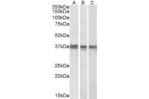 ABIN571286 (1µg/ml) staining of K562 (A), MCF7 (B) and Mouse Liver (C) lysates (35µg protein in RIPA buffer). (POLDIP2 antibody  (Internal Region))