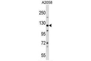 BAT3 Antibody (C-term) western blot analysis in A2058 cell line lysates (35µg/lane). (BAT3 antibody  (C-Term))
