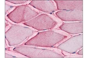 Human Skeletal Muscle: Formalin-Fixed, Paraffin-Embedded (FFPE) (SLC1A5 antibody  (Internal Region))