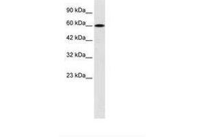 Image no. 2 for anti-Dachshund 2 (DACH2) (AA 525-574) antibody (ABIN6735937) (DACH2 antibody  (AA 525-574))