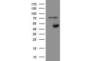 Western Blotting (WB) image for anti-Alcohol Dehydrogenase 7 (Class IV), mu Or sigma Polypeptide (ADH7) antibody (ABIN1496481) (ADH7 antibody)
