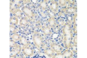 Immunohistochemistry of paraffin-embedded Rat kidney using NAA50 Polyclonal Antibody at dilution of 1:200 (40x lens).