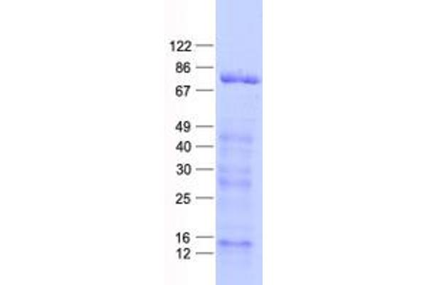 ARHGAP22 Protein (His tag)
