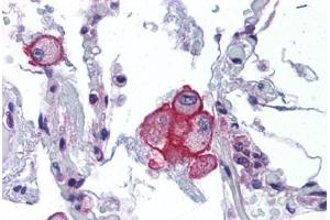 Human Lung: Formalin-Fixed, Paraffin-Embedded (FFPE) (TRPV2 antibody  (AA 595-764))