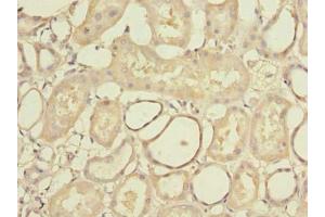 Immunohistochemistry of paraffin-embedded human kidney tissue using ABIN7168993 at dilution of 1:100 (STK33 antibody  (AA 231-514))