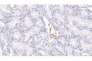 Detection of CFTR in Human Kidney Tissue using Polyclonal Antibody to Cystic Fibrosis Transmembrane Conductance Regulator (CFTR) (CFTR antibody)