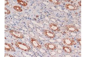 Detection of CK19 in Human Kidney Tissue using Monoclonal Antibody to Cytokeratin 19 (CK19) (Cytokeratin 19 antibody  (AA 245-391))