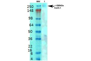 Western Blot analysis of Rat brain membrane lysate showing detection of Cav3. (CACNA1G antibody  (AA 2052-2172) (Biotin))