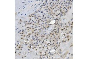 IHC analysis of REC8 using anti-REC8 antibody (ABIN7599473). (REC8 antibody  (AA 1-547))