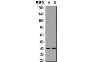 Western blot analysis of PKA C gamma expression in HeLa (A), MCF7 (B) whole cell lysates.