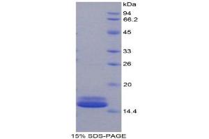 SDS-PAGE (SDS) image for Fatty Acid Binding Protein 4, Adipocyte (FABP4) (AA 2-132) protein (His tag) (ABIN1079481) (FABP4 Protein (AA 2-132) (His tag))