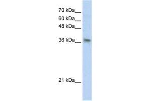Western Blotting (WB) image for anti-Phytanoyl-CoA 2-Hydroxylase Interacting Protein (PHYHIP) antibody (ABIN2460831)