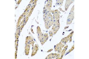 Immunohistochemistry of paraffin-embedded human esophageal smooth muscle using MRPL12 antibody (ABIN5974554) at dilution of 1/100 (40x lens). (MRPL12 antibody)