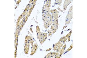 Immunohistochemistry of paraffin-embedded human esophageal smooth muscle using MRPL12 antibody (ABIN5974554) at dilution of 1/100 (40x lens).