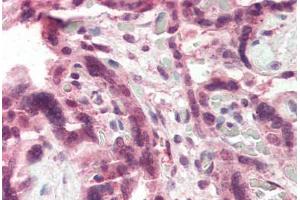 Human Placenta (formalin-fixed, paraffin-embedded) stained with CCKBR antibody ABIN337053 at 5 ug/ml followed by biotinylated anti-goat IgG secondary antibody ABIN481715, alkaline phosphatase-streptavidin and chromogen. (CCKBR antibody  (AA 251-266))