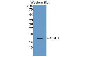 Western blot analysis of the recombinant protein. (Keratin 2 antibody  (AA 508-685))