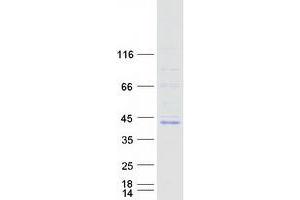 FOXB1 Protein (Myc-DYKDDDDK Tag)