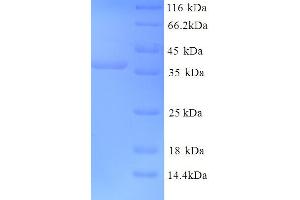 GRIK5 Protein (AA 143-238, Extracellular) (GST tag)