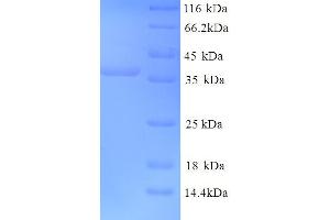 SDS-PAGE (SDS) image for Glutamate Receptor, Ionotropic, Kainate 5 (GRIK5) (AA 143-238), (Extracellular) protein (GST tag) (ABIN4974873)