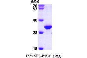 SDS-PAGE (SDS) image for HIV-1 Tat Interactive Protein 2, 30kDa (HTATIP2) (AA 1-242) protein (His tag) (ABIN667152)