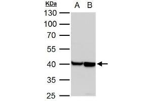 WB Image alpha Actin (cardiac muscle) antibody detects alpha Actin (cardiac muscle) protein by western blot analysis.
