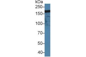 Western blot analysis of Human Jurkat cell lysate, using Rat ITGaM Antibody (1. (CD11b antibody  (AA 31-160))
