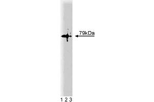 Western blot analysis of PKCtheta on a Jurkat lysate. (PKC theta antibody  (AA 21-217))
