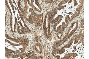 Immunohistochemistry analysis using Rabbit Anti-MDM2 Polyclonal Antibody (ABIN5667994). (MDM2 antibody  (AA 100-200) (Atto 390))