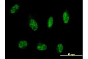 Immunofluorescence of purified MaxPab antibody to MTMR8 on HepG2 cell. (MTMR8 antibody  (AA 1-704))