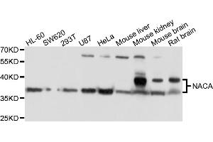 Western blot analysis of extracts of various cell lines, using NACA antibody (ABIN4904484) at 1:1000 dilution.