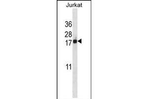 BANF1 Antibody (Center) (ABIN657992 and ABIN2846938) western blot analysis in Jurkat cell line lysates (35 μg/lane). (BANF1 antibody  (AA 37-65))