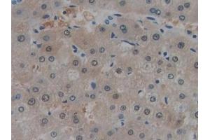 #VALUE! (MT-ND1 antibody  (AA 186-270))