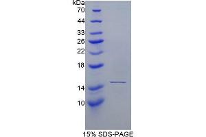 SDS-PAGE (SDS) image for Haptoglobin (HP) (AA 44-157) protein (His tag) (ABIN1878513) (Haptoglobin Protein (HP) (AA 44-157) (His tag))