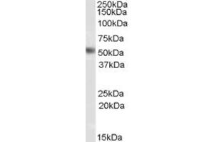 Western Blotting (WB) image for anti-ArfGAP with GTPase Domain, Ankyrin Repeat and PH Domain 1 (AGAP1) (Middle Region) antibody (ABIN2788993) (AGAP1 antibody  (Middle Region))