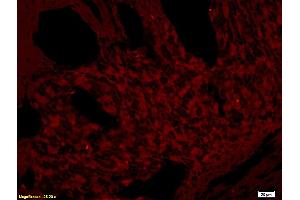 Formalin-fixed and paraffin embedded rat skin tissue labeled with Rabbit Anti-CD272/BTLA Polyclonal Antibody (ABIN671031), Unconjugated at 1:200 followed by conjugation to the secondary antibody and DAB staining. (BTLA antibody  (AA 221-289))