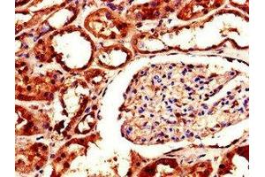 Immunohistochemistry of paraffin-embedded human kidney tissue using ABIN7143637 at dilution of 1:100 (AKR1A1 antibody  (AA 2-325))