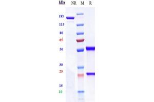 Anti-IGF1R / CD221 Reference Antibody (lonigutamAb) on SDS-PAGE under reducing (R) condition. (Recombinant IGF1R (Lonigutamab Biosimilar) antibody)