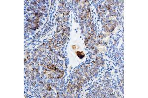 IHC analysis of EEF2 using anti-EEF2 antibody (ABIN7599561).
