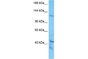 Western Blotting (WB) image for anti-Zinc Finger Protein GLI1 (GLI1) (C-Term) antibody (ABIN2779593)